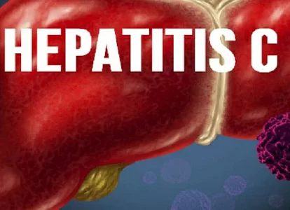 Сколько стоит лечение гепатита С: доступно ли оно всем?